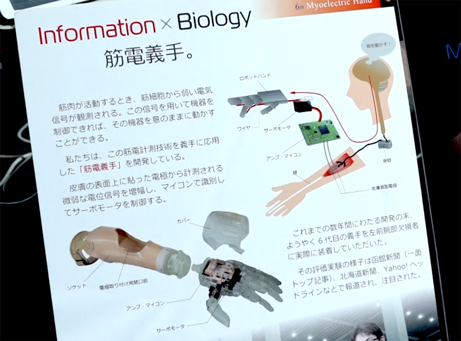 筋電義手の概要イメージ